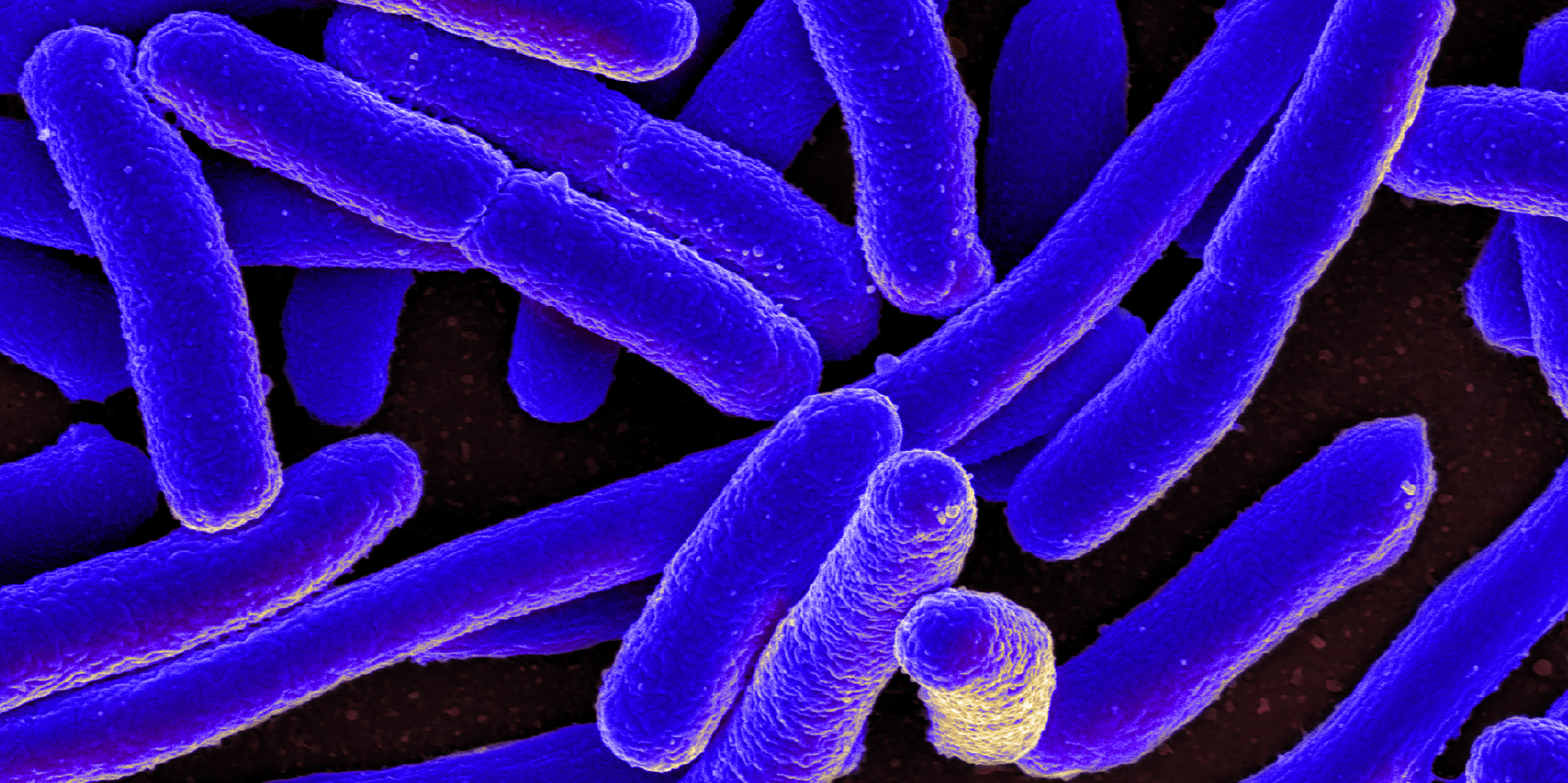 Image of E. coli