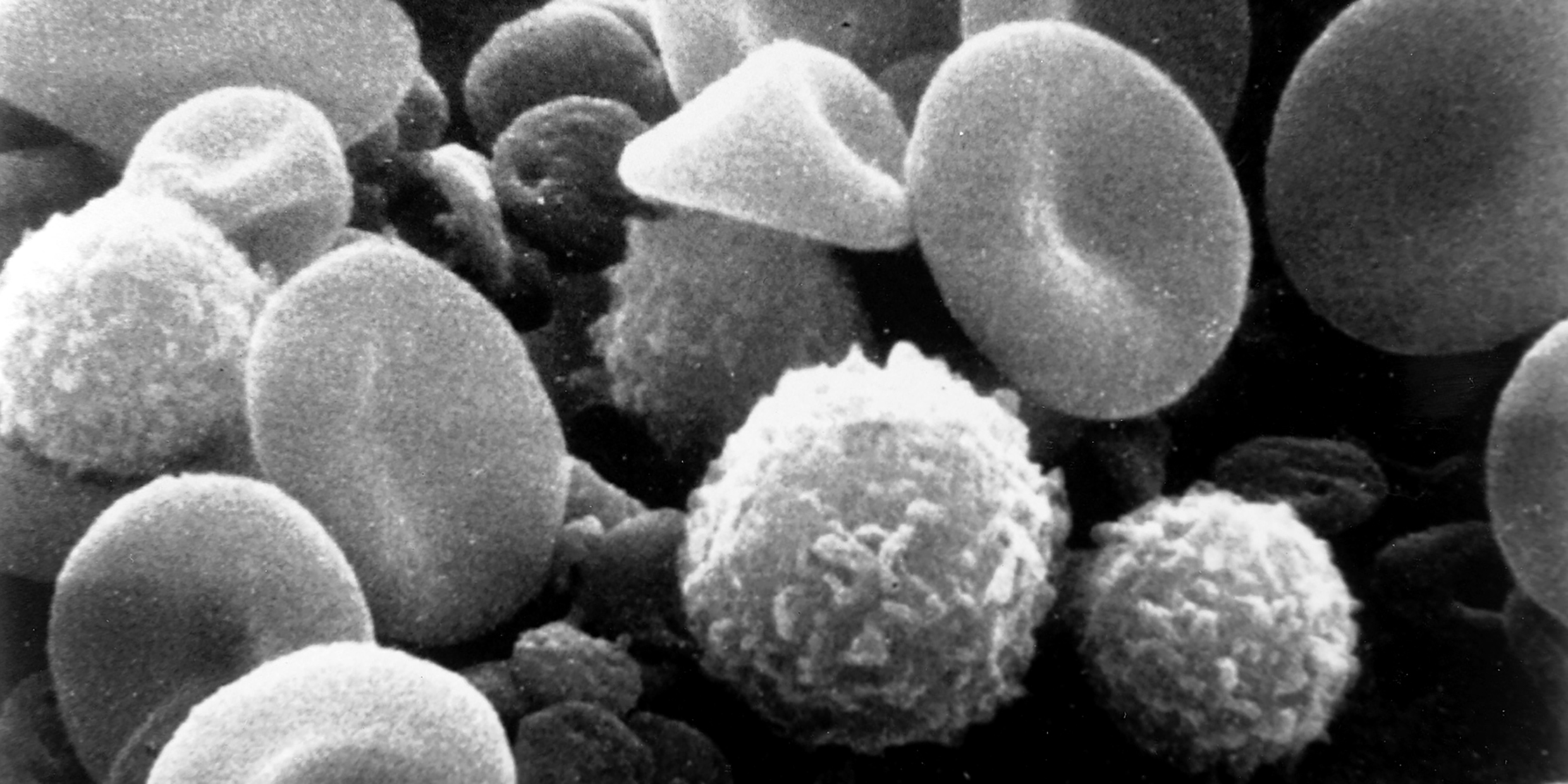 Image of blood cells and lymphocytes