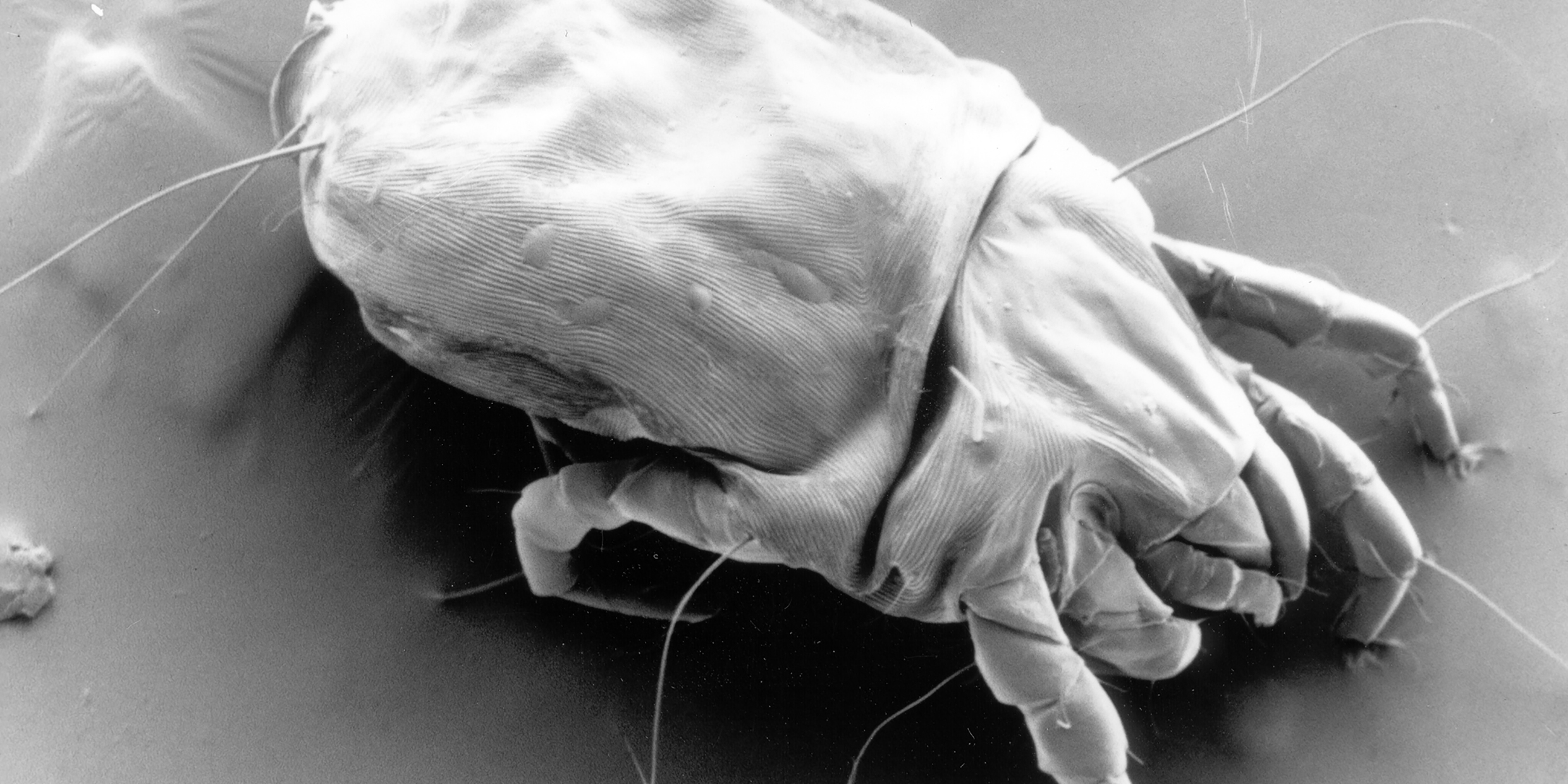 Electron micrograph of a mite