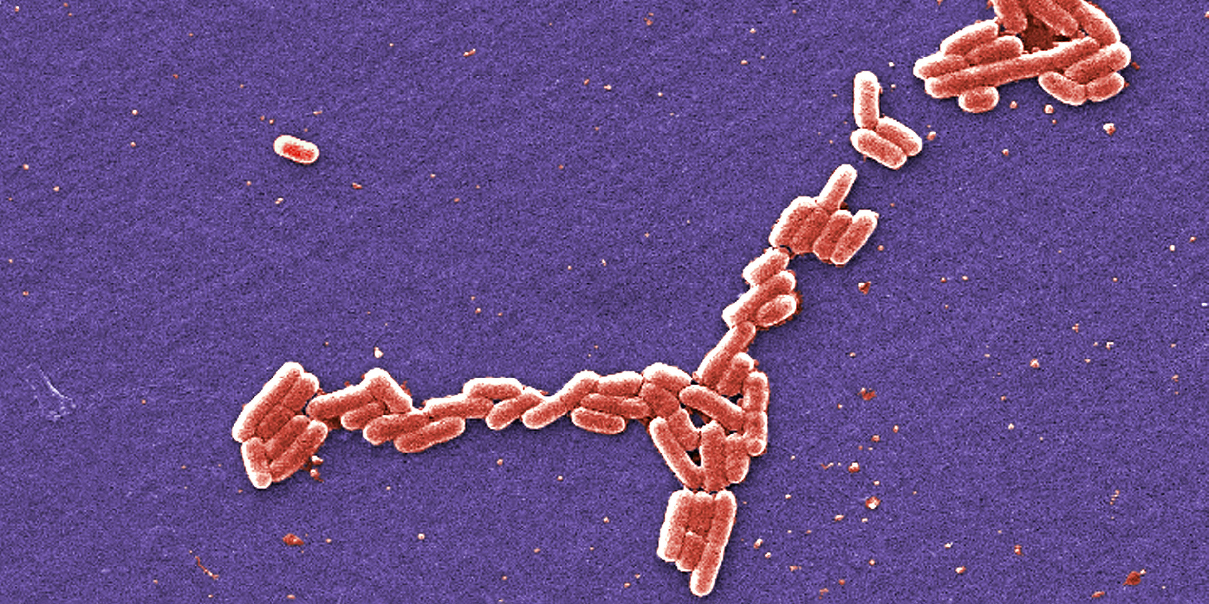 Microscopic image of E. coli bacteria