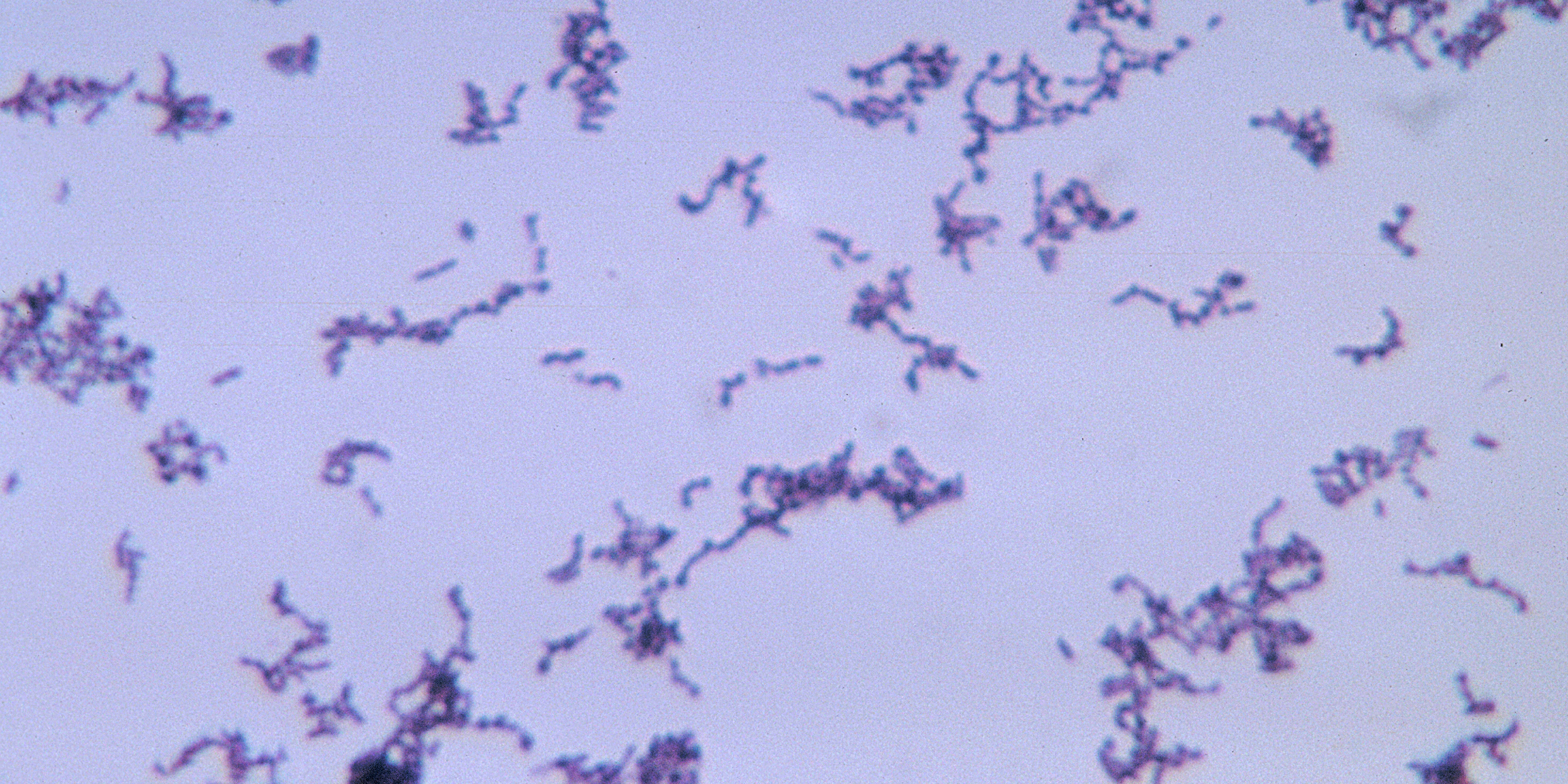 Microscopic image of Propionibacterium