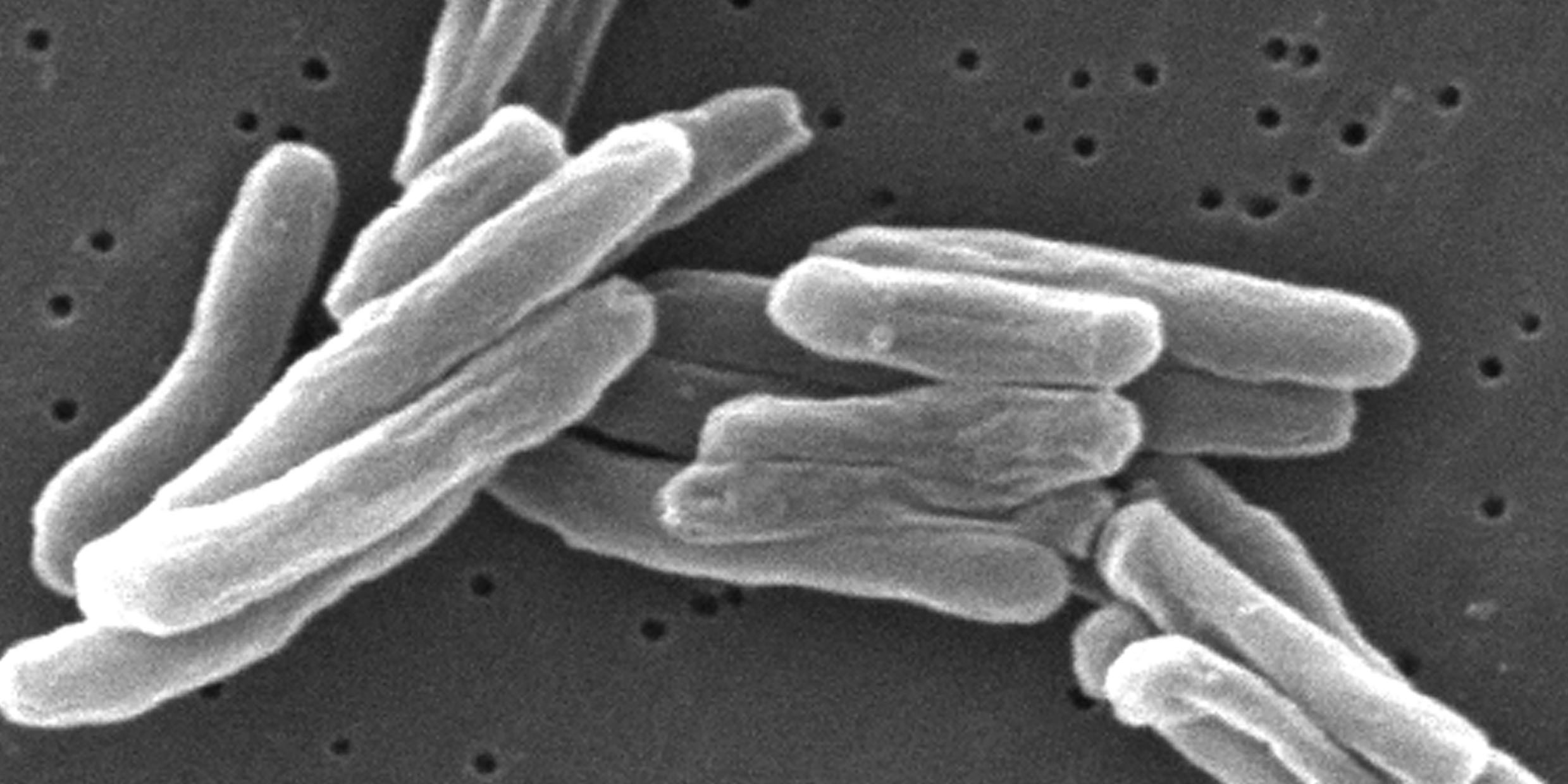 Microscopic image of bacteria