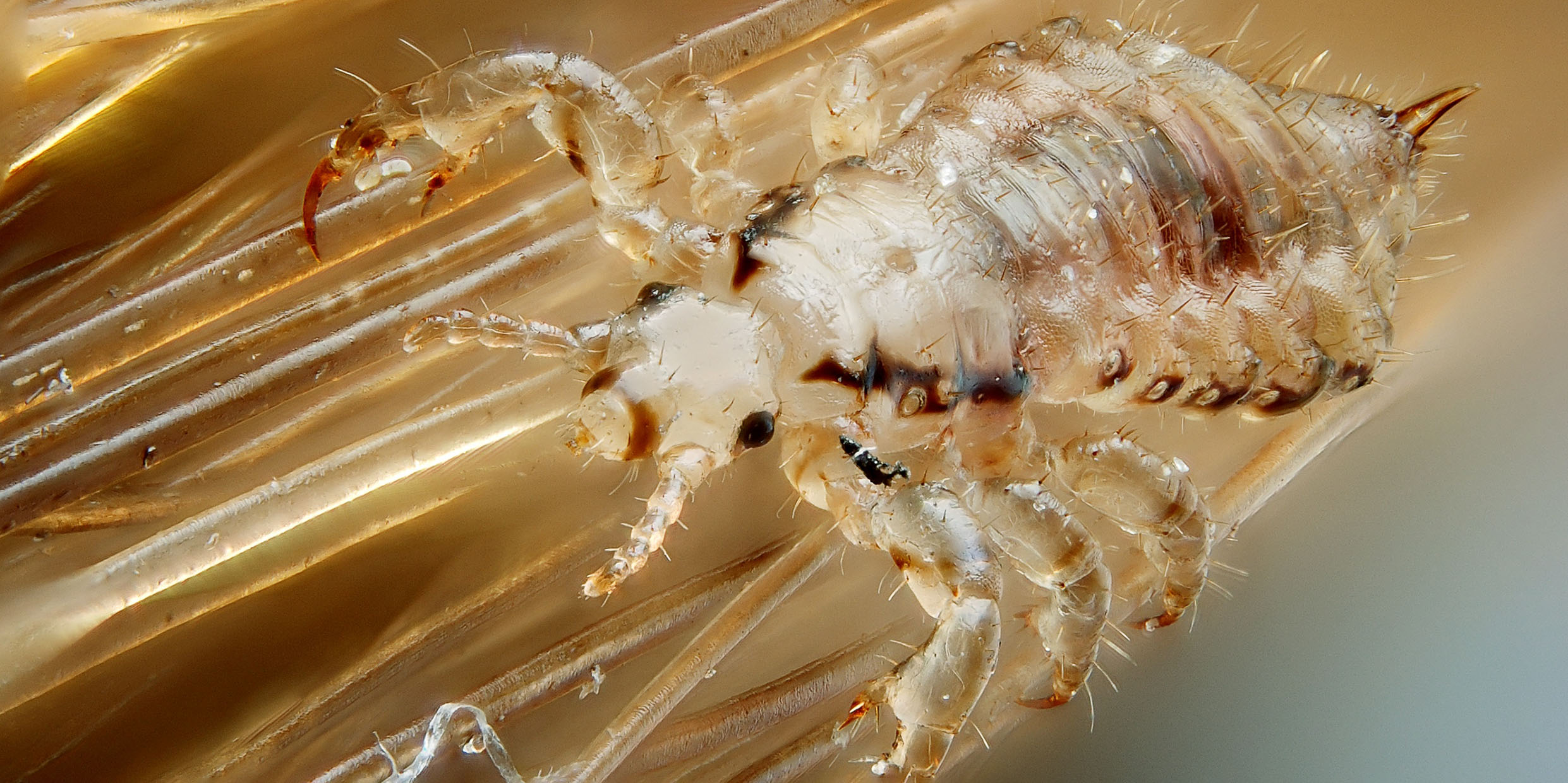 Microscopic image of a head louse